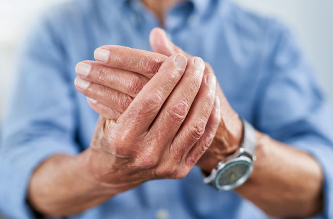 What YOU can do about your arthritis